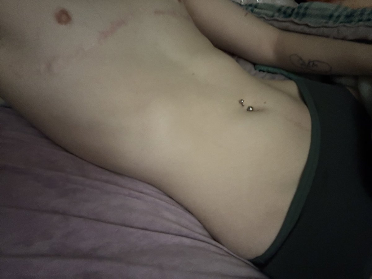 _suguruzsys's tweet photo. Day 2 of body checking myself . 50kg 18.3 bmi https://t.co/LRZ5l5QC9L