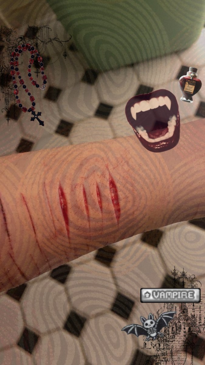 skinned_fl3sh's tweet photo. fake vampire bite sfx makeup 
#sh #shtwt #ai #edit #slittwt https://t.co/zkPUpkLRzg
