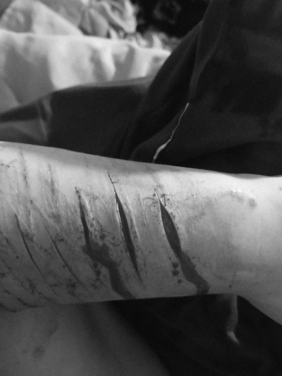 coolbunny8008's tweet photo. ALL FAKE ALL MAKEUP SFX

i can only do my arms now oooo
#shrtwt https://t.co/hexpZQaqrQ