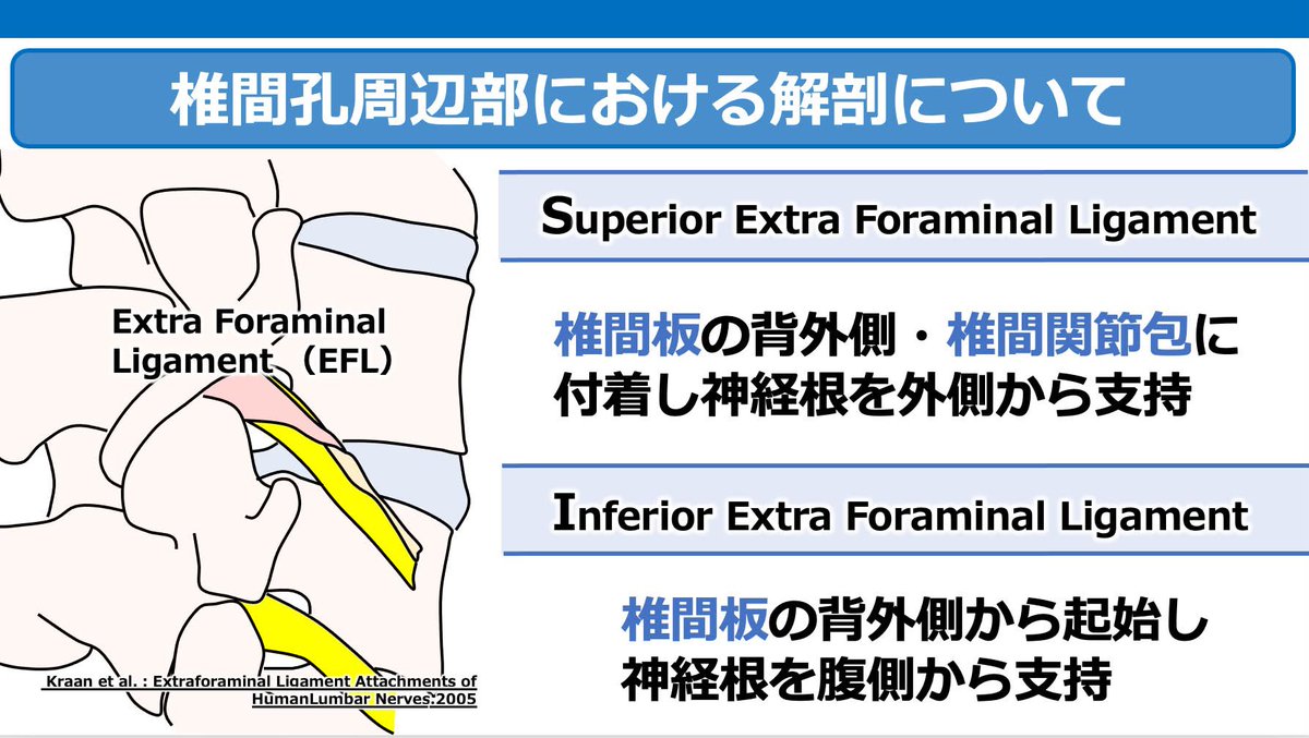 Spo_Lab's tweet photo. 「腰椎椎間孔狭窄症」を徹底解説！

▶️ 椎間孔内・外の組織に関する解剖学的知見 ▶️ 椎間孔狭窄症に特徴的な症状 ▶️ 画像所見とその評価のポイント

本セミナーでは、これらの内容を詳しく解説した上で、機能解剖学に基づき、椎間孔内・外における病態をどのように推定するのか？
ーー
脊椎の視点から”大腿部の痛み”を再考する 
〜機能解剖から紐解く評価と運動療法〜 
https://t.co/aJcyjbvfqk