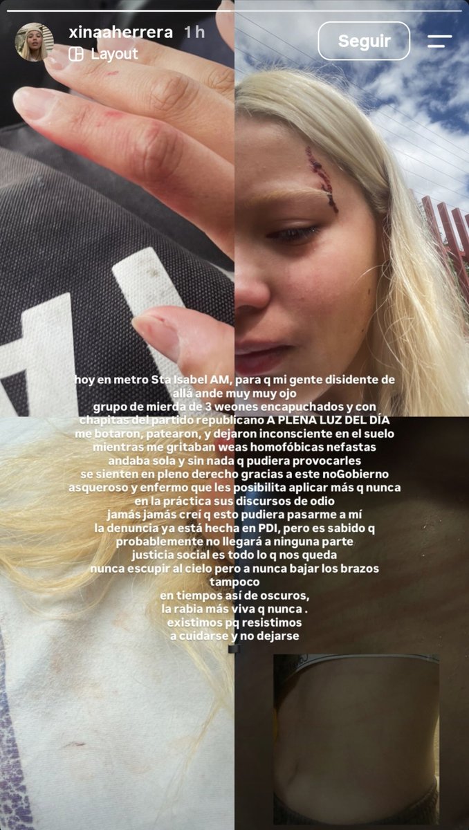 soldeinviernq's tweet photo. la ultraderecha siempre va a traer odio https://t.co/GgNJNLsJu1