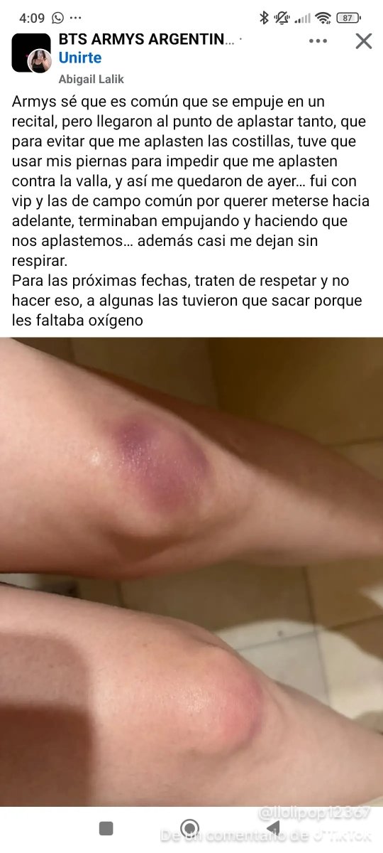 alexambts13's tweet photo. Que bonito verdad ? 

Ojalá está foto la vea Jimin o algunos de los chicos https://t.co/gAVOV6lEHl