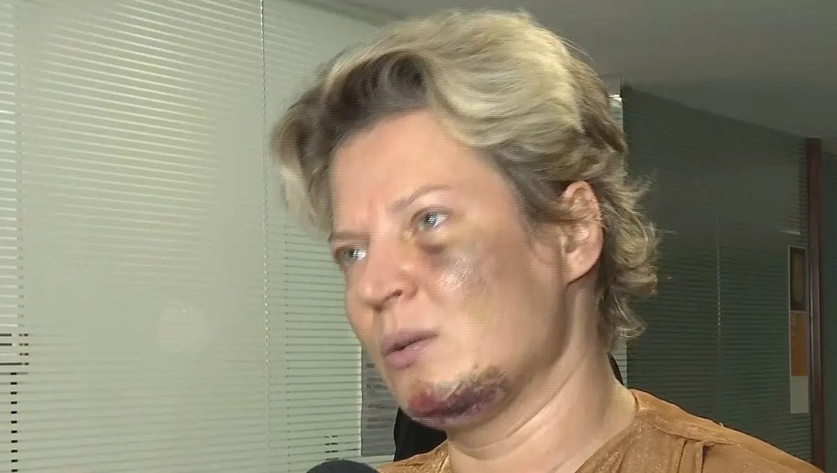 centralreality's tweet photo. Eu estou em completo estado de CHOQUE. Ela não morreu por um milagre mesmo! https://t.co/HYIgvsXCeB