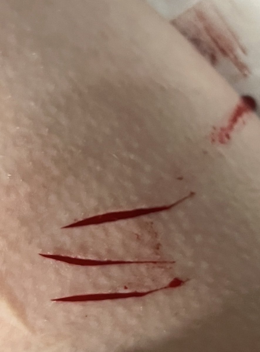 SpraksAhoy's tweet photo. Little baaaaaby sfx makeup for Halloween!!
#sfxmakeup https://t.co/BvmW4g9k3n