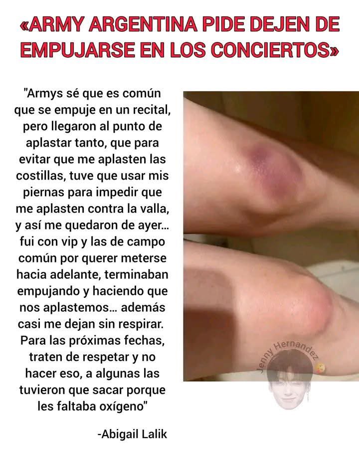 JiminLatinoFB's tweet photo. Ojo con esto de empujones, hacia las filas de adelante, incluso personas están denunciando ☠️😱 no lo hagas para los siguientes dos conciertos. Esto fue publicado en Facebook.

Empujar hacia delante es asfixiar personas, ella tuvo que apoyarse en sus piernas, para evitar que aplastaran sus costillas