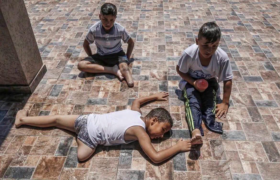 Astridueil's tweet photo. A horrifying image of Gaza's children, marking the highest number of child amputees in history. https://t.co/SrRQwF8LS2