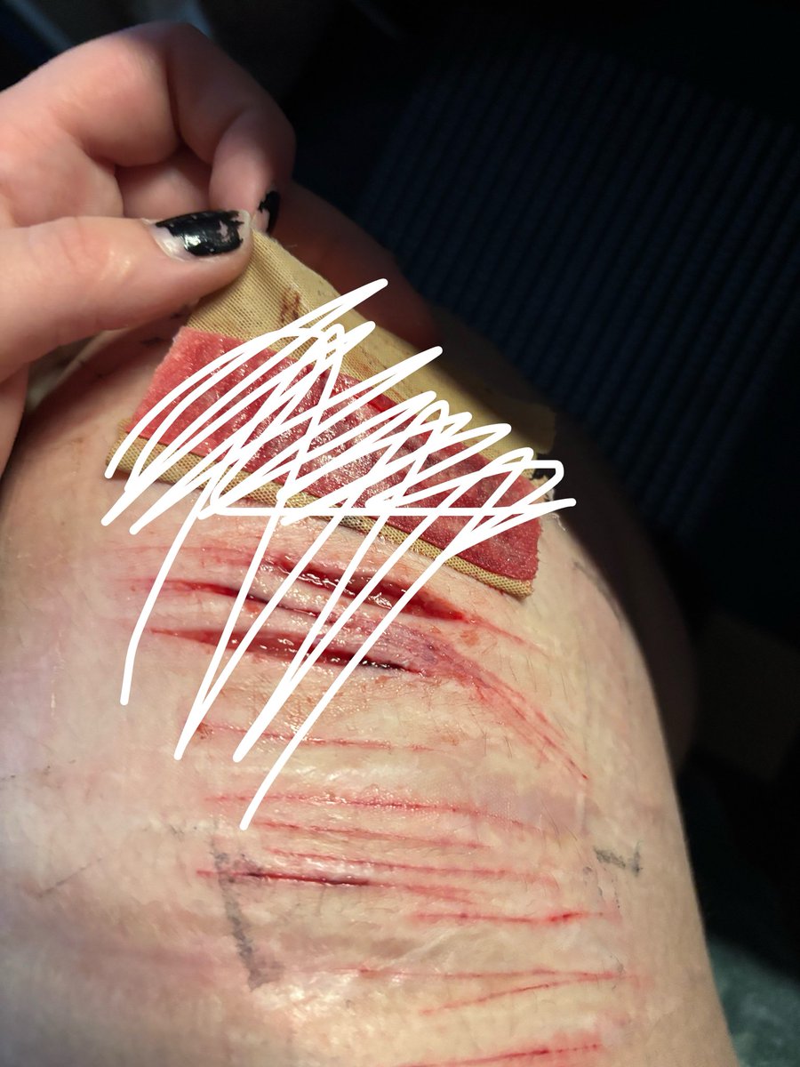cuteater666's tweet photo. cunt..... sfx makeup https://t.co/vEg2bDQFlq