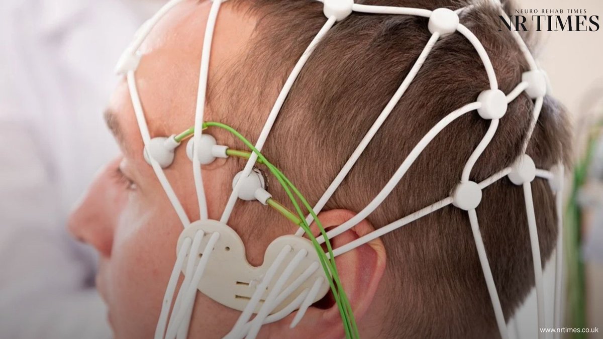 editorNRTimes's tweet photo. A brain-computer interface allowed about one in three unresponsive patients with acute brain injury to control a beeping tone using their thoughts.
🔗 Full story: https://t.co/j0qQNXKV2f
#BrainInjury #BrainComputerInterface #EEG #Neurotechnology #DisordersOfConsciousness https://t.co/4O1K9hv0HB