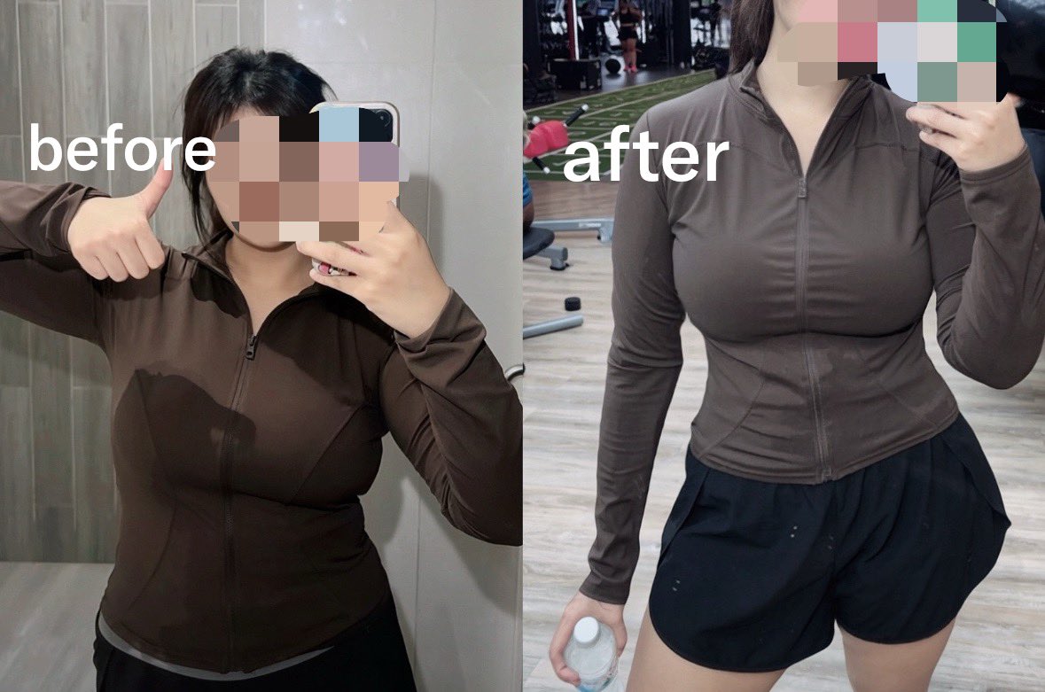 maddyzbad's tweet photo. สุขภาพกายอันดับ 1 สุขภาพจิตอันดับ 2 🏋🏼‍♀️🤍

ตอนน้ำหนัก 90 kg สุขภาพแย่มาก เหนื่อยง่าย ป่วยบ่อย pcos ภูมิแพ้คือรุมเร้า ค่าใช้จ่ายเยอะ เลยเป็นห่วงตัวเองในระยะยาว เพราะช่วงนึง แค่เดินไปเดินมาก็เหนื่อยแล้ว นี่เลยคิดได้ว่าถ้าแก่ไปจะทำไง

แล้วอีกอย่างนึงชั้นถูกบูลลี่เรื่องรูปร่าง  ผิวพรรณ ความสะอากาด กลิ่นตัว จนเสียความมั่นใจ เสียสุขภาพจิตมาตั้งแต่เด็ก จนเกลียดตัวเองมากๆ ไม่กล้าใส่เสื้อผ้าที่ชอบ ต้องคอยเลือกชุดเพื่อพรางหุ่น แทนที่จะได้แต่งตัวอย่างสนุกและเป็นตัวเอง 🥹
 
  มันเลยเป็นแรงบัลดาลใจ ให้อยากลดความอ้วนครั้งสุดท้ายเพื่อที่จะได้มีสุขภาพกายและสุขภาพจิตที่ดีขึ้น 🫂💖🫶🏻