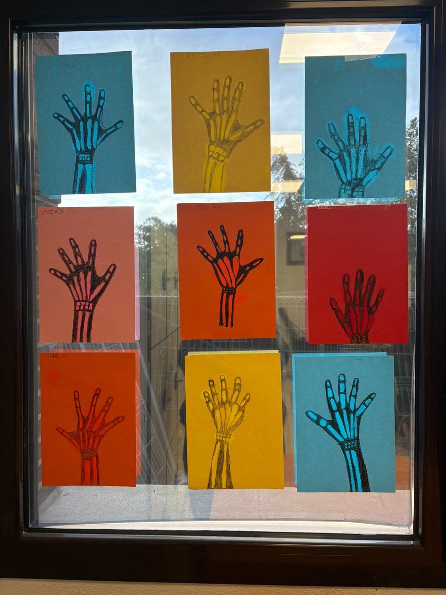 StPatricksSS's tweet photo. 🦴 El alumnado de 2.º de Primaria experimenta con la translucidez y el cuerpo humano creando sus propias radiografías caseras.

🎨 Ciencia y creatividad de la mano para aprender de forma divertida. Science is amazing!

#TogetherShapingTheFuture https://t.co/RnEL3YWesm