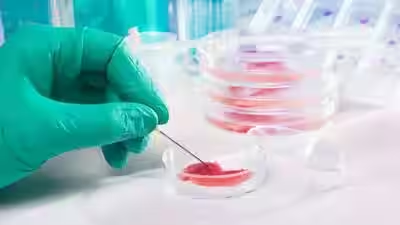 agingdoc1's tweet photo. Scientists turn blood-cell precursors from an 80-year-old donor into neural stem cells with epigenetic age below 20; 100-day process reveals cellular rejuvenation could aid aging and Alzheimer's research

https://t.co/mzbdhetDfs https://t.co/PMNCysZEIm
