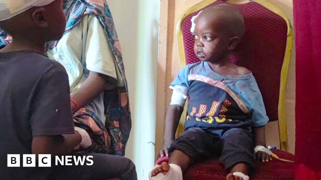 BBCAfrica's tweet photo. "Deeply disturbing." 

UN human rights chief Volker Türk reacts to a BBC investigation finding evidence that the RSF systematically destroyed hospitals in Sudan, stating the actions may amount to war crimes. https://t.co/7XYLTNBrWB https://t.co/NOZ3jsEJst
