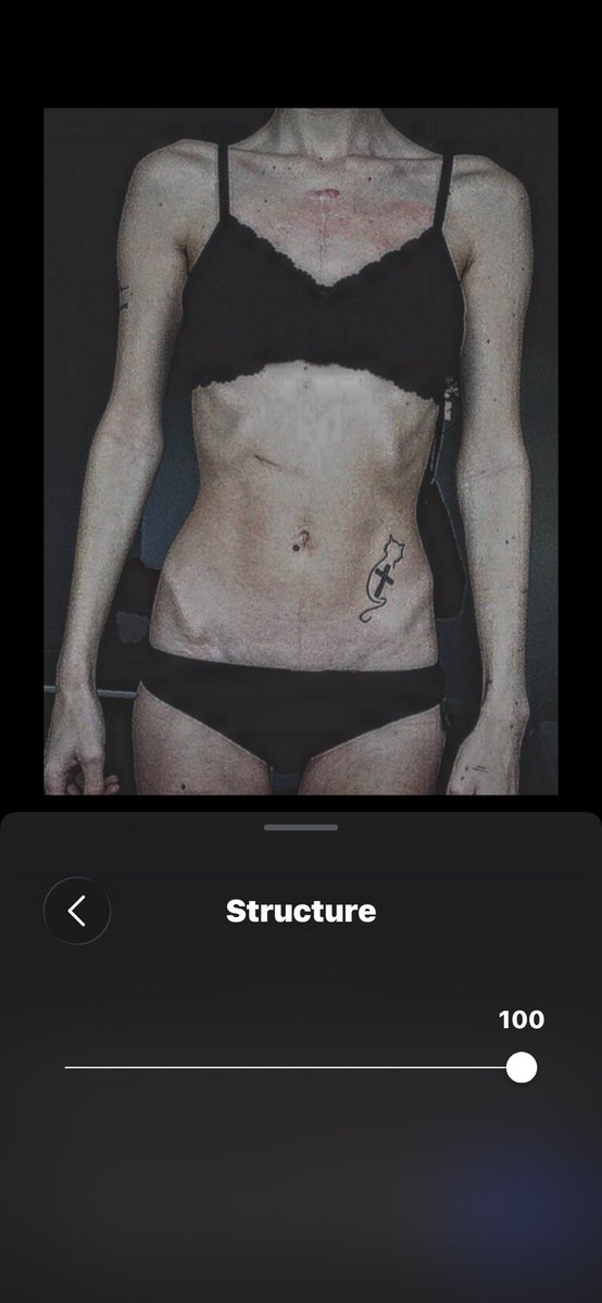 deadlythintea's tweet photo. This is how I use to look. B4 I started lifting &amp; weight under 90lbs ( ps edited to make darker and sharper so you can see better as brightness on he original were too much ) https://t.co/dxhE5BKiAE
