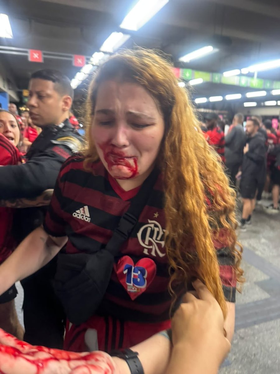 hackensackx's tweet photo. boa tarde gente! não sou de expor muito minha cara mas tem coisa que não dá pra passar batido.

hoje por volta de 00:20 na estação de são cristóvão do @metro_rio eu fui agredida NO ROSTO pela supervisora iara com um cassetete no meio de uma confusão com a qual eu NÃO estava + https://t.co/y8baYqENqh