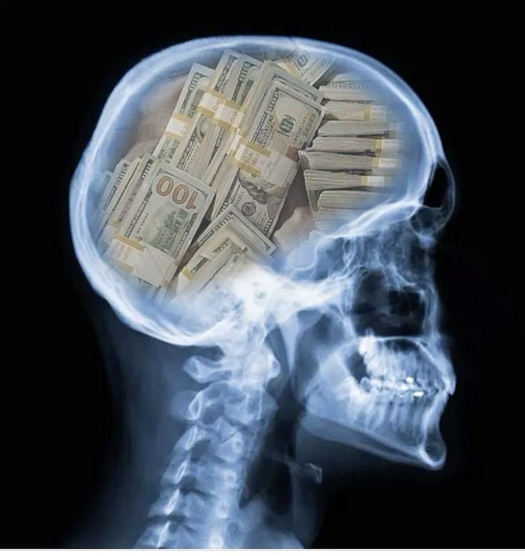 ManOfFocus_'s tweet photo. My mind, 24/7. https://t.co/yiQaWe0vCl
