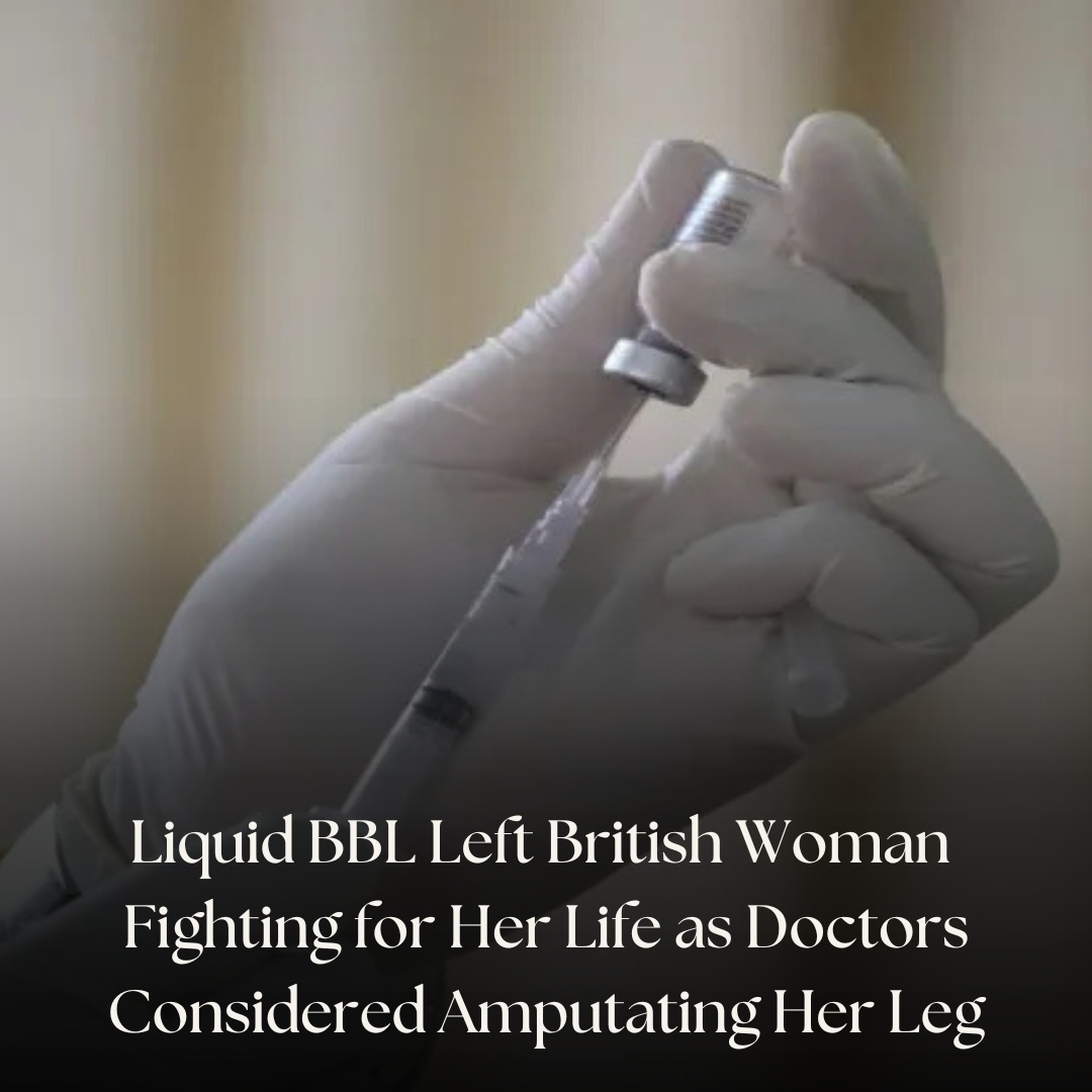 IBTimesUK's tweet photo. Louise Moller nearly lost her leg after a liquid Brazilian butt lift caused sepsis
#LiquidBBL #CosmeticSurgery #PatientSafety
Read More : https://t.co/ADQoTXhDur https://t.co/L10c1myNvJ https://t.co/TpNvhQvFgz