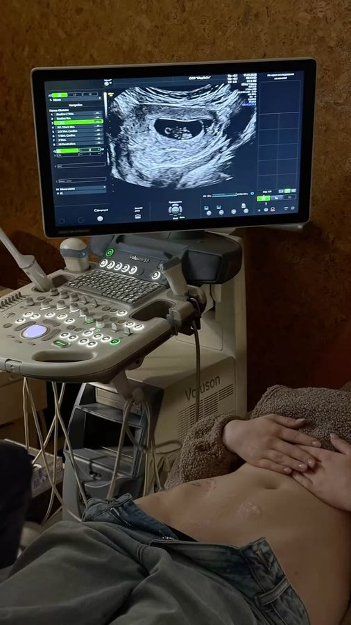 cozxylover's tweet photo. She gave me the good news that day... She was pregnant. She asked me to go with her to the hospital for her first ultrasound. https://t.co/O2a72hmeK2