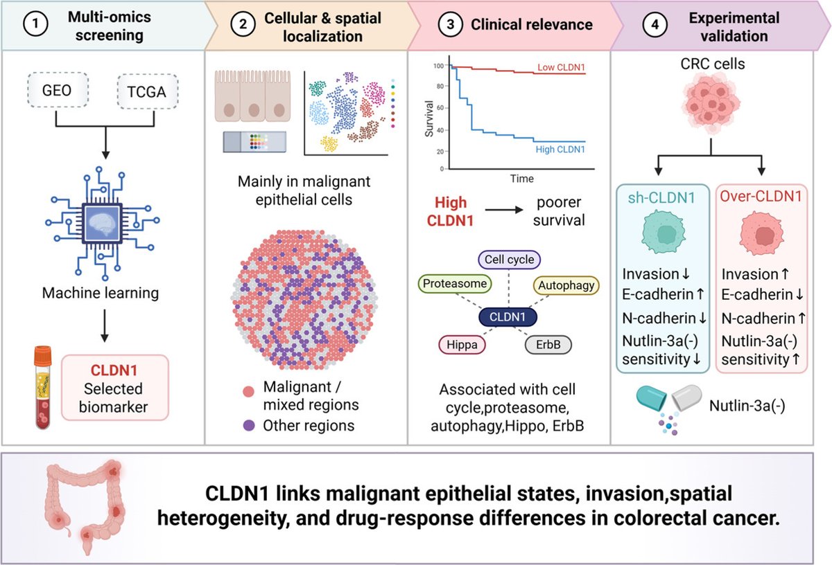 Intestinal_Cell's tweet photo. 📢 New research supports CLDN1 as a candidate colorectal cancer-associated marker linked to malignant epithelial-cell states, tumor-associated spatial heterogeneity, invasive phenotype, and Nutlin-3a (−) response.

#OpenAccess👉 : https://t.co/9lcfYE9AEu

#ColorectalCancer #IntestinalResearch