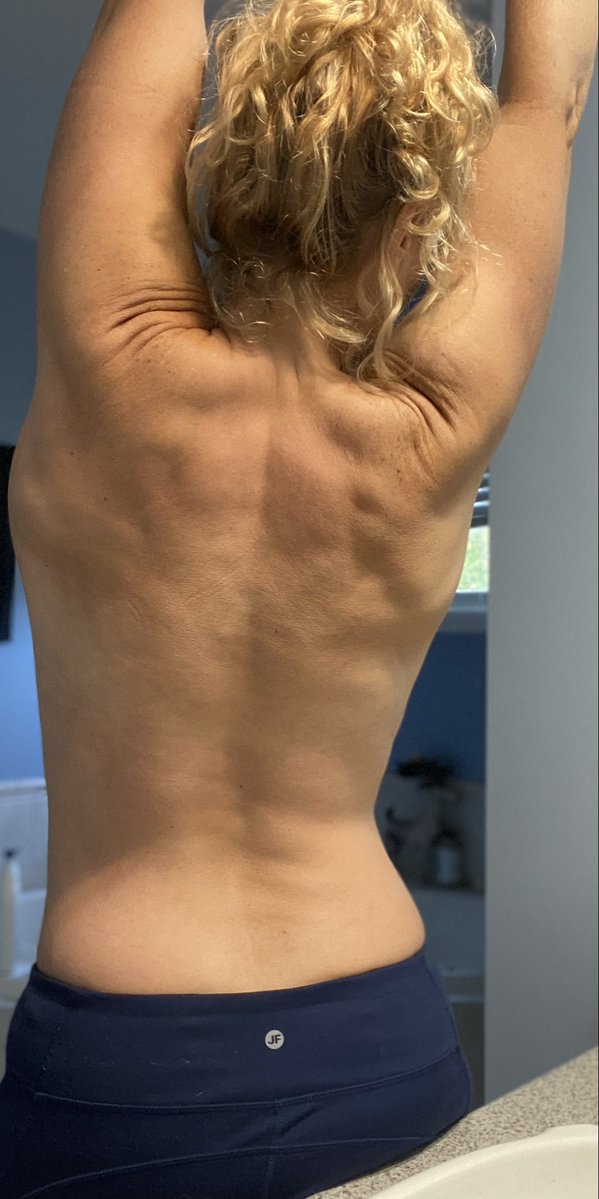Lettergirl101's tweet photo. 54 years old
2 babies
Post menopausal
Perseverance
Consistency 
Discipline 
Showing you, what can be done...no excuses.
Any age, any stage.💕💕 https://t.co/lUKrFntwfQ