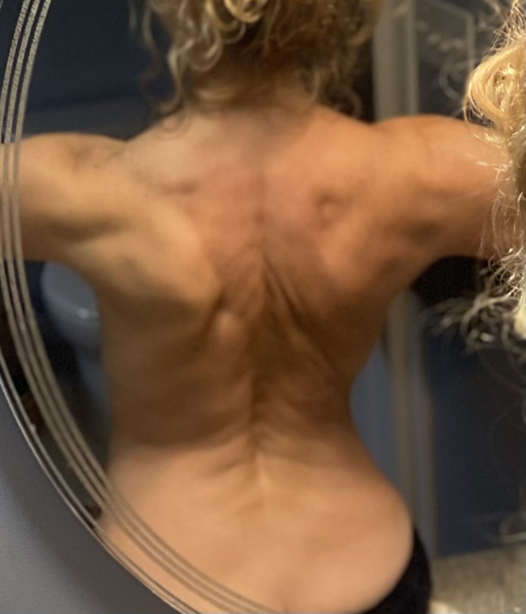 Lettergirl101's tweet photo. 54 years old
2 babies
Post menopausal
Perseverance
Consistency 
Discipline 
Showing you, what can be done...no excuses.
Any age, any stage.💕💕 https://t.co/lUKrFntwfQ