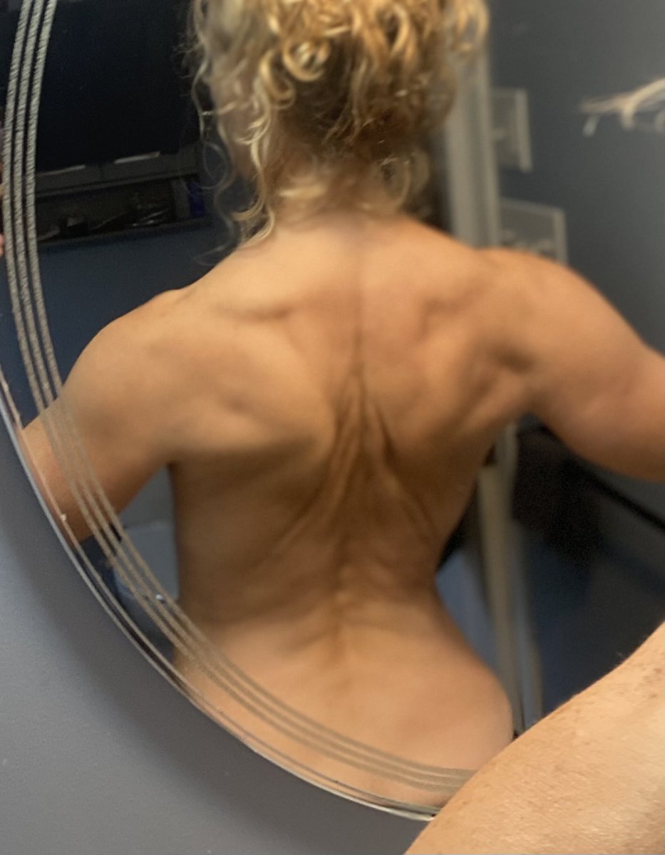Lettergirl101's tweet photo. 54 years old
2 babies
Post menopausal
Perseverance
Consistency 
Discipline 
Showing you, what can be done...no excuses.
Any age, any stage.💕💕 https://t.co/lUKrFntwfQ