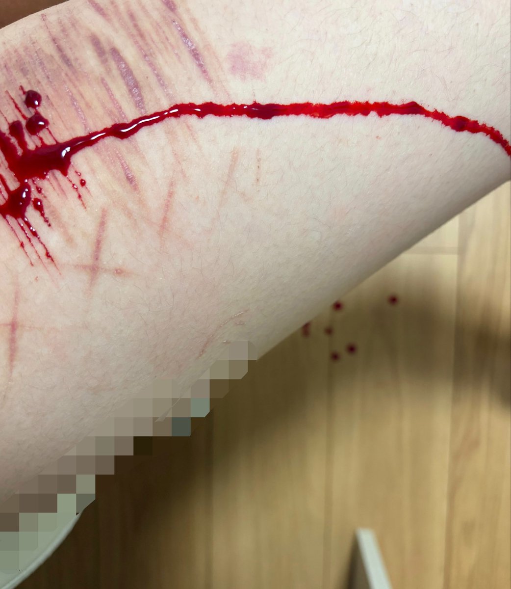 pzrs106's tweet photo. #sfxmakeup  #fake  #sh https://t.co/hCPx0JDlMD