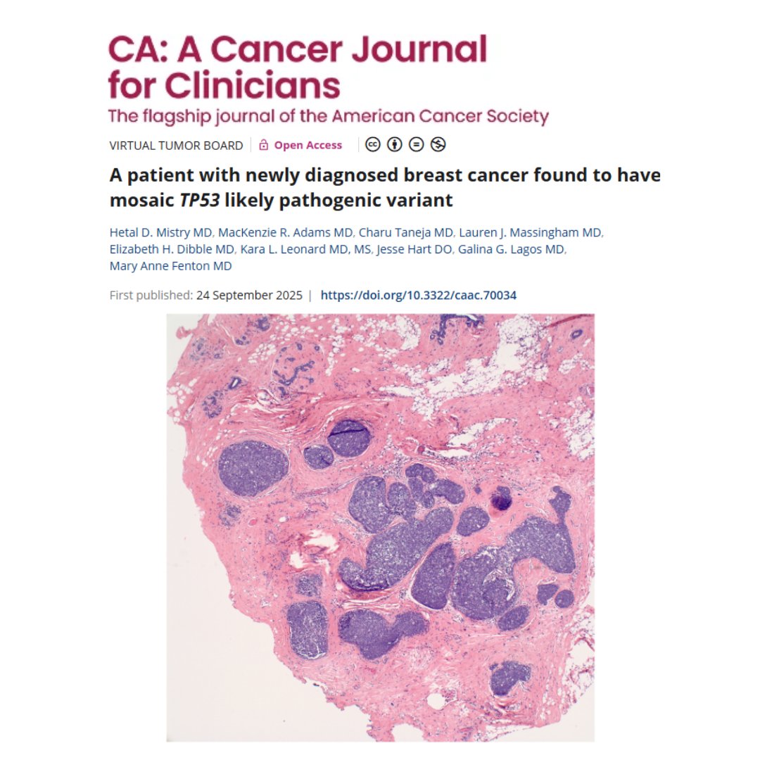 CACancerJournal's tweet photo. 🧬In young patients w/ #BrCa, it's critical to obtain a history and assess genetic risk. A 2025 tumor board from @BrownMedicine shows how deep genetic analysis and multidisciplinary work led to a mosaic TP53 likely pathogenic variant.

https://t.co/0adY9KGGah

@OncoAlert #BCSM https://t.co/mM8eNLx5Vw