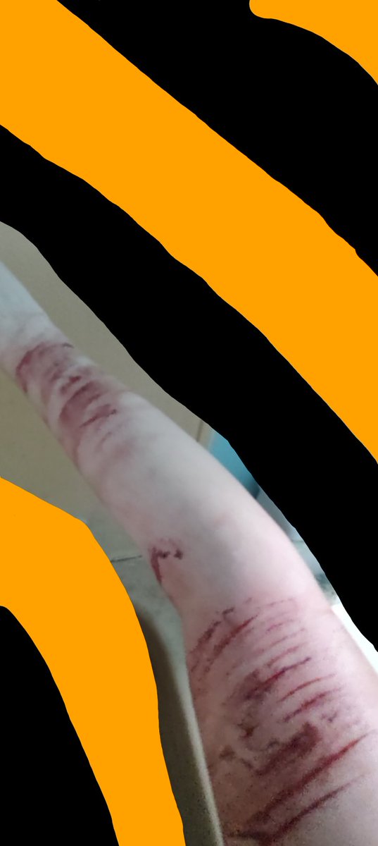 styrozoey's tweet photo. @FreakyFem26685 #sfxmakeup 
Already done! Here's a little bonus photo I took of my other arm. I love Halloween so much!!! 🥰 https://t.co/Ho508Idnwi