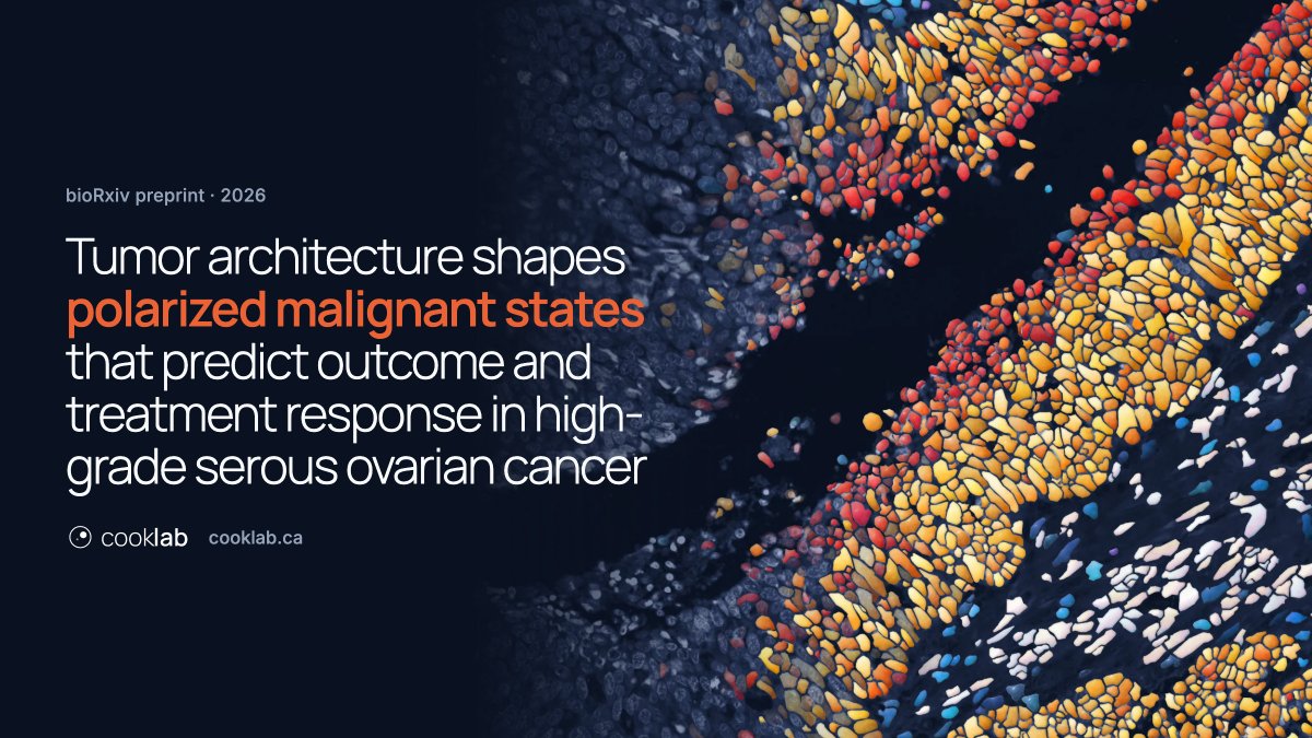 DavidPCook's tweet photo. Excited to share the first publication from the lab, led by Sarah Nersesian and John Abou-Hamad!

Tumor architecture shapes polarized malignant states that predict outcome and treatment response in high-grade serous ovarian cancer

https://t.co/OeGtiHzDd4
(Preprint link below) https://t.co/rufimdRgb9