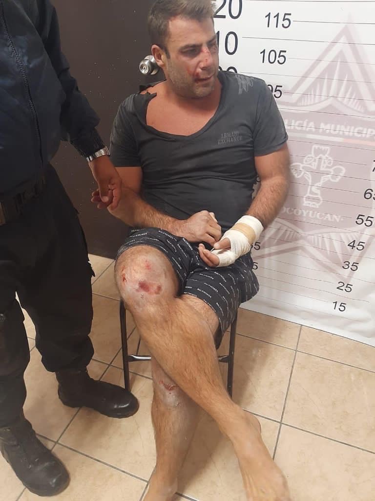 unagresor_menos's tweet photo. Se les olvida cuando lo detuvieron en Santa Clara Ocoyucan? Lo iban a linchar por casi atropellar a unos habitantes de ahí.
Cuando llegó la policía se hizo el loco y dijo no saber cómo se llamaba.
En lomas rompió la pluma del parque y amenazó q varias personas con pistola. https://t.co/hHquwBp31O