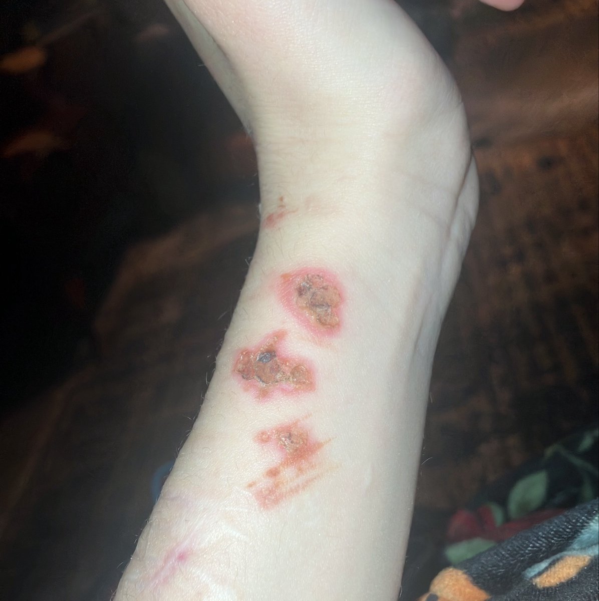 cupcakecuttr's tweet photo. sfx burns for haloween https://t.co/oeI70YmlIZ