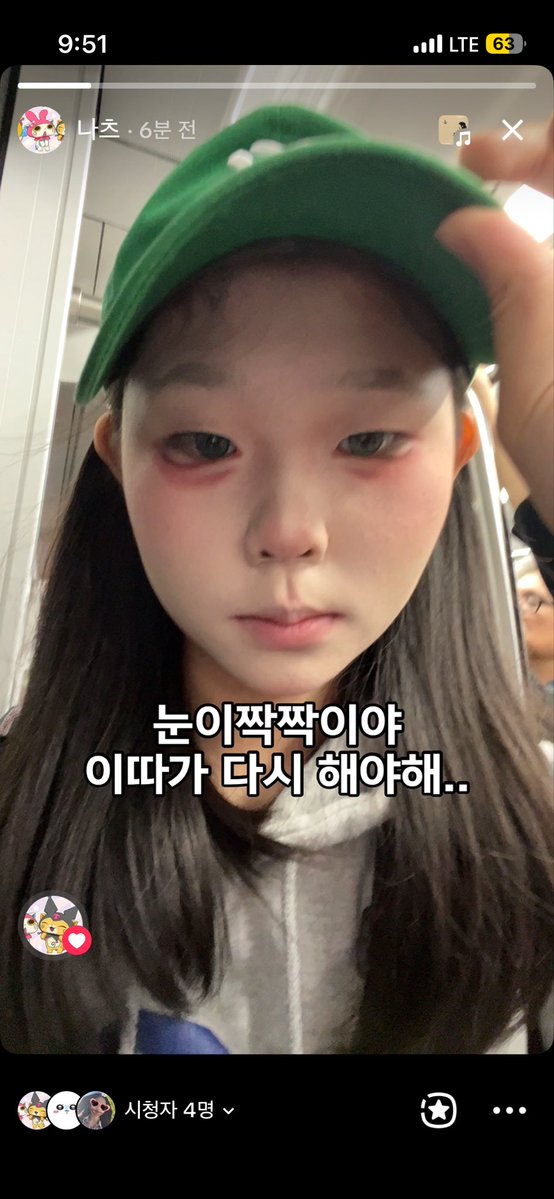 mfodkr's tweet photo. 눈 짝짝이 진짜ㅠ https://t.co/eLnBq2GDYS