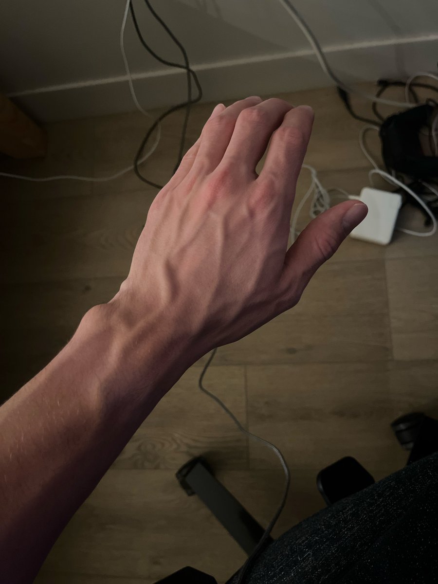 supitsdominic's tweet photo. veins are a humans wires https://t.co/v07uh31fz2