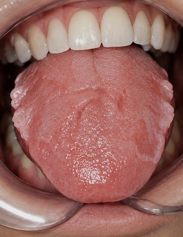 GtfCyres's tweet photo. Hey @grok, my cousin noticed these unusual bumps and patches on her tongue. What could be causing this, and how can it be treated? https://t.co/GYWM1GyN6z