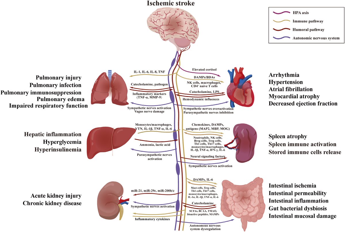 MaximumAcademic's tweet photo. #Targetome
Reframing ischemic stroke as systemic disease, this review maps brain-gut-heart-liver-spleen-lung-kidney crosstalk and proposes combined therapies targeting central and peripheral organs.
@NatureNeuro @EANeurology #BrainOrganAxis
Details: https://t.co/M1onwxXO9B https://t.co/qHwSWTj6Wn