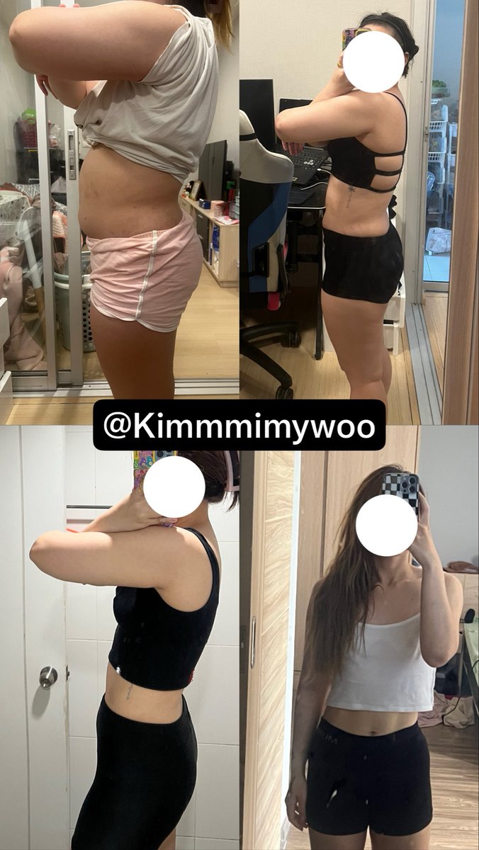 Kimmmimywoo's tweet photo. หลังจากการลดน้ำหนักและไขมันของเราทั้งหมด 15 kg ภายใน 6 เดือน ขอเสริมนิดนึงนะคะ เราใช้ "การเวทเทรนนิ่ง (Weight training)" ตั้งแต่วันแรก ยันปัจจุบัน 

ขอให้ดู ความเปลี่ยนแปลงแต่ละช่วงนะคะ การเวทควบคู่ไปกับการคุมอาหาร ทานโปรตีนให้เพียงพอ 

ทำให้ เนื้อของเราไม่ย้วยค่ะ สังเกตดูว่ากล้ามเนื้อจะค่อยๆกระชับ ฉะนั้นเวทกันเถอะค่ะ การลดลงเร็วไม่ได้ดีเสมอไป เราต้องดูร่างกายด้วยนะคะ