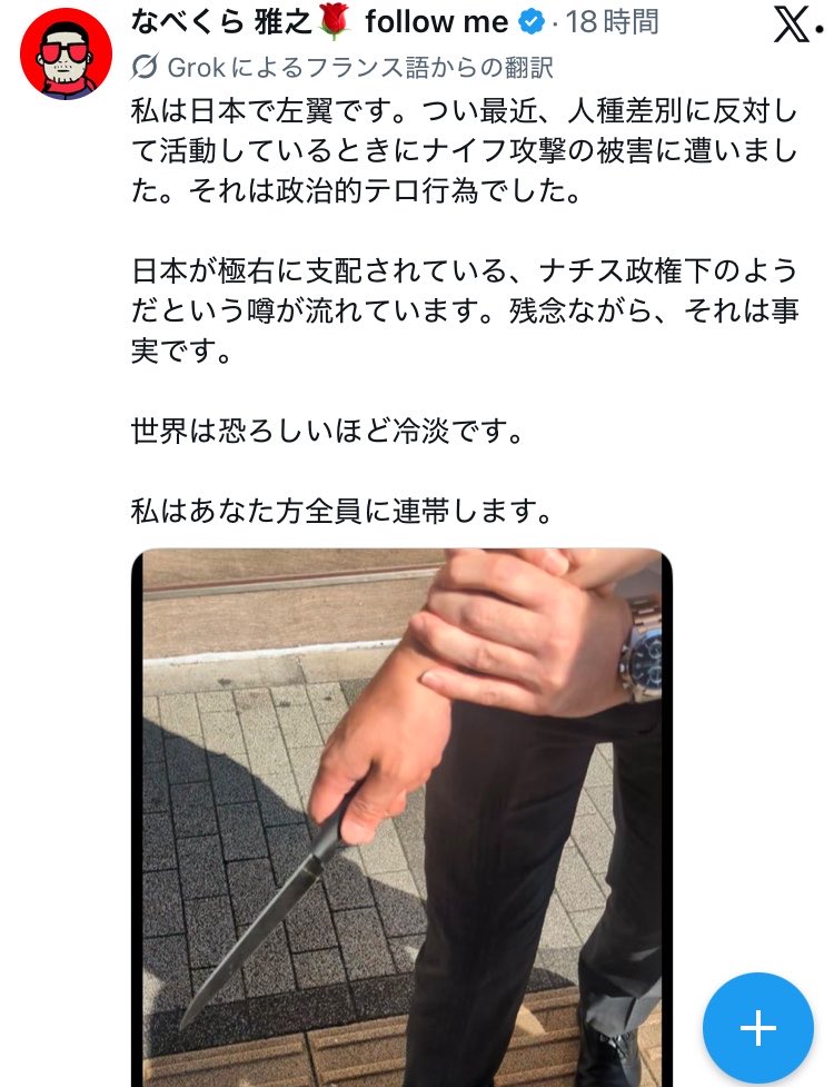 minaminpyo's tweet photo. やらせ乙w
もし、ナイフを持った人物の手をつかんで制止した瞬間を撮影したのであれば、激しい応酬でブレるとかあるだろw
なんで撮影者が近距離でバッチリ撮影できてるんやw
普通は距離を取り、避難して警察を呼びます。わざわざ写真を撮影しに近寄るなんて無理ですよ。お友達でない限りはねw https://t.co/BViJGA9l44