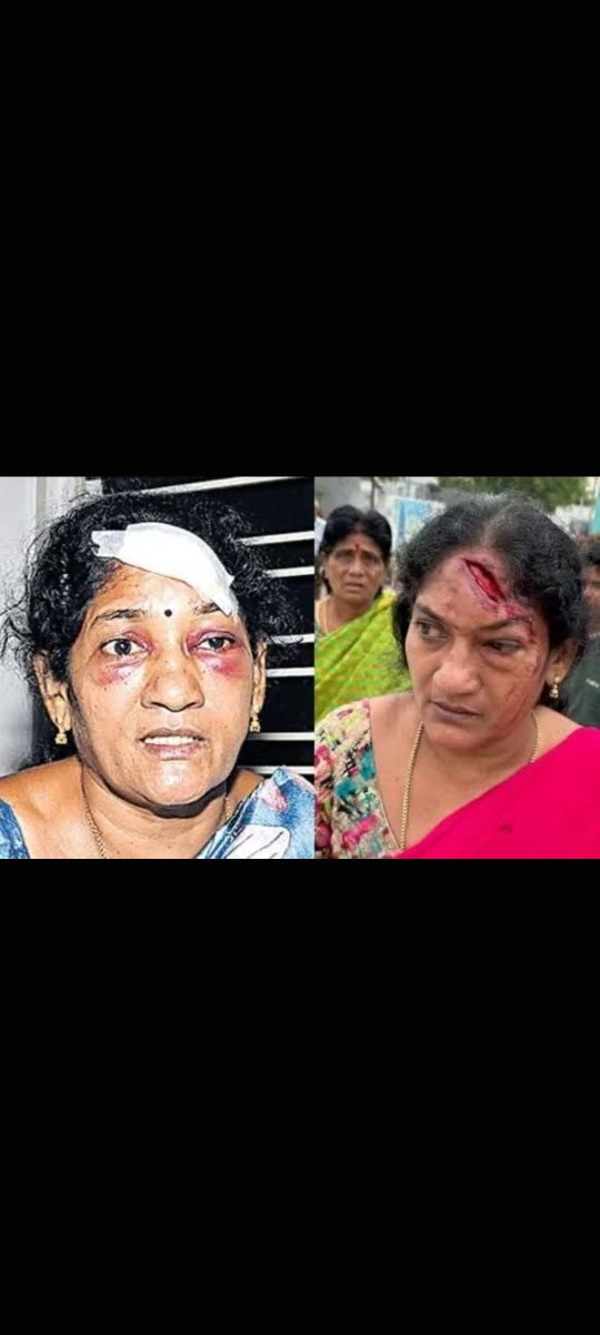 SRA_Reddy's tweet photo. They talk about the Women’s Reservation Bill, but look at her now—she’s was allegedly being attacked with an axe to stop her from filing her nomination. Is this the state of women’s safety and democracy in India? India is in a serious crisis, @rashtrapatibhvn @BBCWorld @cnnbrk https://t.co/DSrDbDzMzC