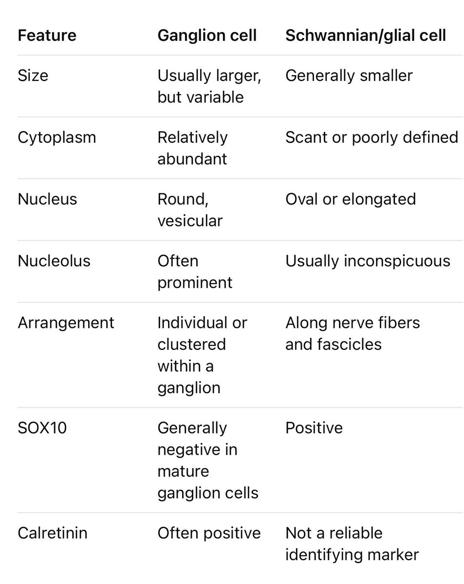 drpathai's tweet photo. GANGLION CELL OR SCHWANN CELL? ONE MISTAKE CAN CHANGE A CHILD’S DIAGNOSIS!

In #HirschsprungDisease, not every stained cell is a ganglion cell!

Ganglion cells: Larger neuronal bodies, vesicular nuclei, prominent nucleoli and abundant cytoplasm.

Schwannian cells: Small, elongated nuclei, scant cytoplasm, associated with nerve bundles.

The immunostain trap:

• Calretinin: Highlights many ganglion cells and intrinsic mucosal nerve fibers.
• SOX10/S100: Highlight Schwannian/glial elements—not proof of ganglion cells.
• HuC/D: Helps identify neuronal cell bodies.

The golden rule: A positive stain is NOT a diagnosis. Morphology + location + immunophenotype matter!

#Pathology #PediatricPathology