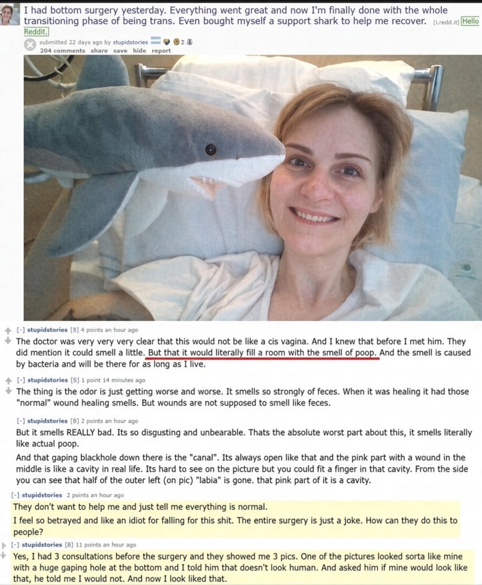 CopperCation's tweet photo. It's not misogyny, it's the truth. 

Men don't have vaginas. 

If someone chooses to have their penis surgically removed, then that's their decision. The result of that surgery, however, is not a vagina.
This procedure carries very real and debilitating side effects. It involves removing a perfectly healthy organ, after which the body instinctively tries to heal itself.

Imagine being a nurse today and having to train for complications arising from cases like the man described in the story below?