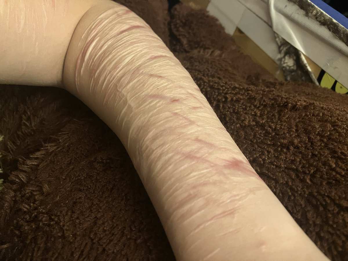 cupcakecuttr's tweet photo. healed sfx makeup 
it dosent even feel like i have scars fr https://t.co/ybH3k72ioQ