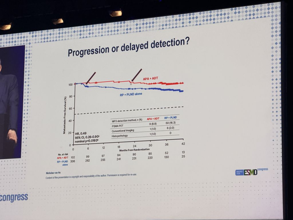 alantanmd's tweet photo. #ESMO26 PROTEUS discussion by Nicholas van As
• No baseline PSMA PET; enrolled conventionally staged M0
• MFS events: true progression or delayed detection? Most were PSMA PET-detected (8.8% vs 16.3%)
• TTST HR 0.29, but ~20-mo lead-time bias
#ProstateCancer https://t.co/FfugtpcYwU