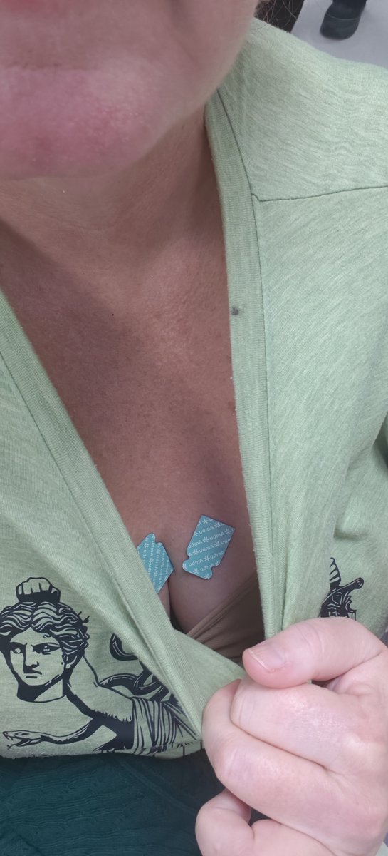 flaminhaystacks's tweet photo. Today I wasn't feeling good and called 111 for advice. They sent an ambulance and after multiple tests, I have now been admitted to A&amp;E for cardiac observations overnight

Not exactly what I was planning for the weekend 

Hoping they can find out what is wrong https://t.co/mivwf0MlqE