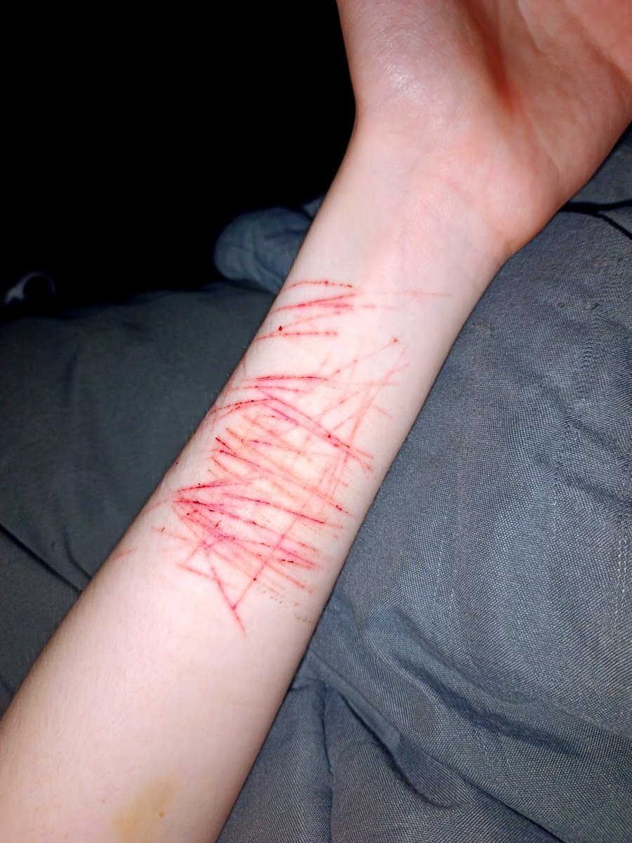 DeathKli's tweet photo. it looks terrible, I should have thought at least a little bit about how to do it, and not just fuck off. My laziness will kill me one day.
⦻
#sfh #988twt #sh #fakeblood https://t.co/pKcLebXSf6