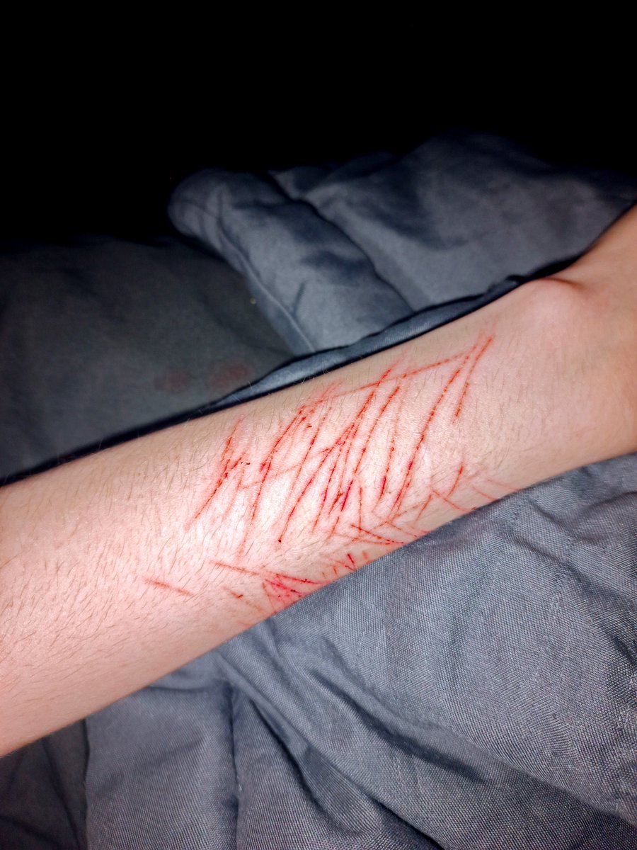 DeathKli's tweet photo. it looks terrible, I should have thought at least a little bit about how to do it, and not just fuck off. My laziness will kill me one day.
⦻
#sfh #988twt #sh #fakeblood https://t.co/pKcLebXSf6