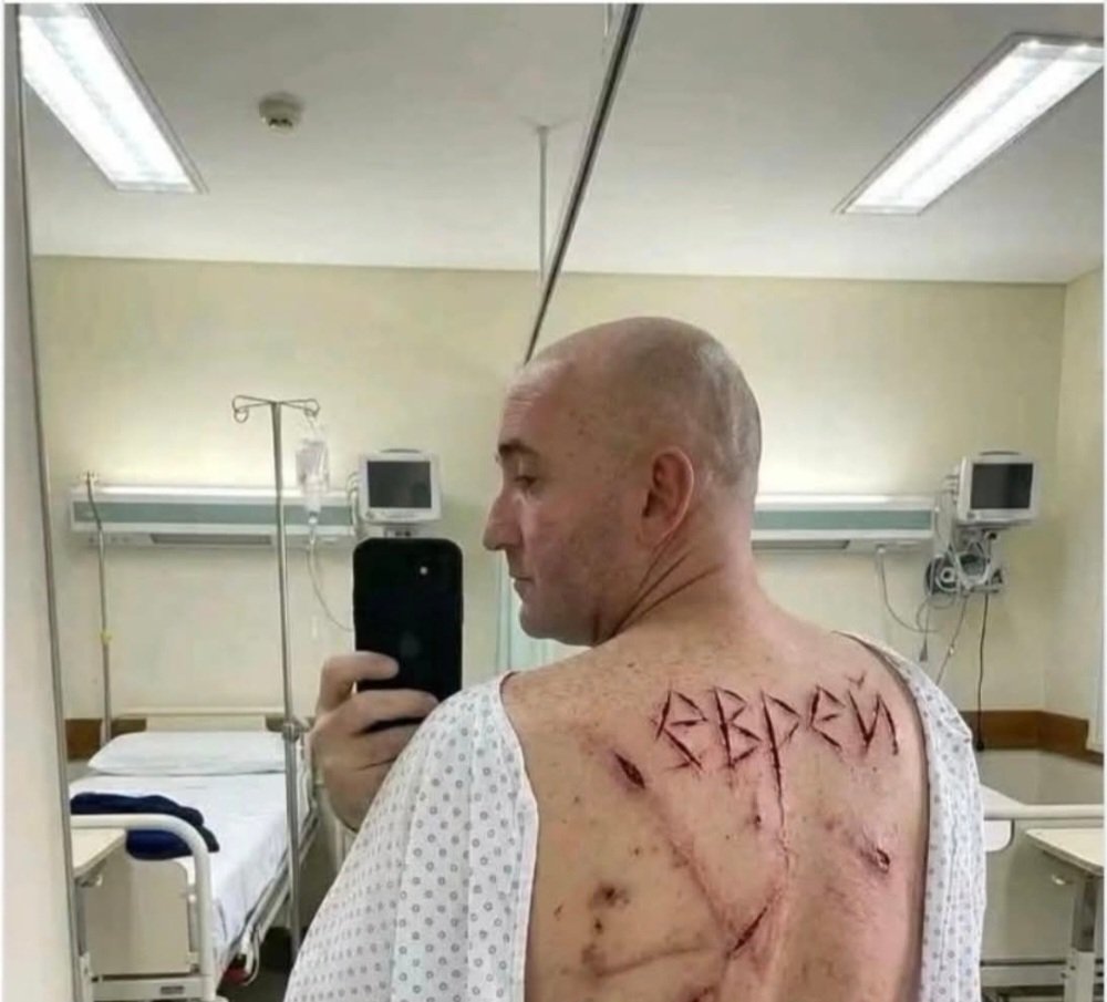 AzPetrich's tweet photo. 270 Ukrainian soldiers were released from Russian captivity this week. One had the Russian word for "Jew" carved into his back. The Russian soldiers are no different from the Nazi's and they're certainly not humanitarians.

This is devastating. https://t.co/L8iFRfzsad