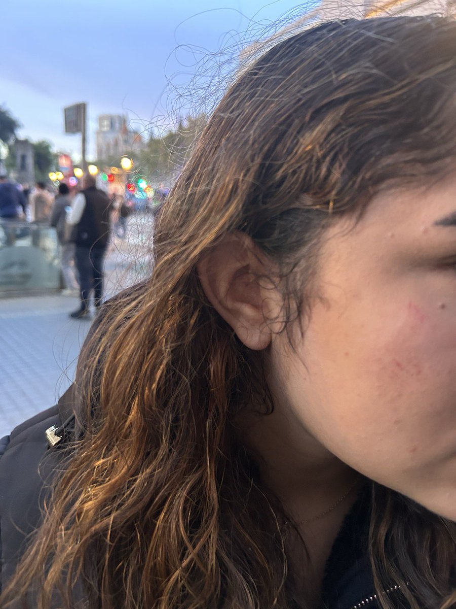 HoritzoS's tweet photo. 🟢| Molts joves, la majoria menors d’edat, han sigut ferits durant les actuacions de la policia per evitar la mobilització. https://t.co/WLSTBhMzOj