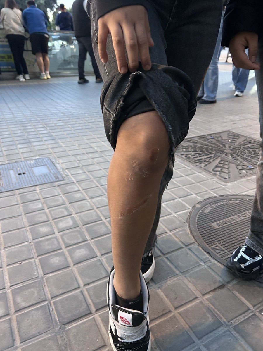 HoritzoS's tweet photo. 🟢| Molts joves, la majoria menors d’edat, han sigut ferits durant les actuacions de la policia per evitar la mobilització. https://t.co/WLSTBhMzOj