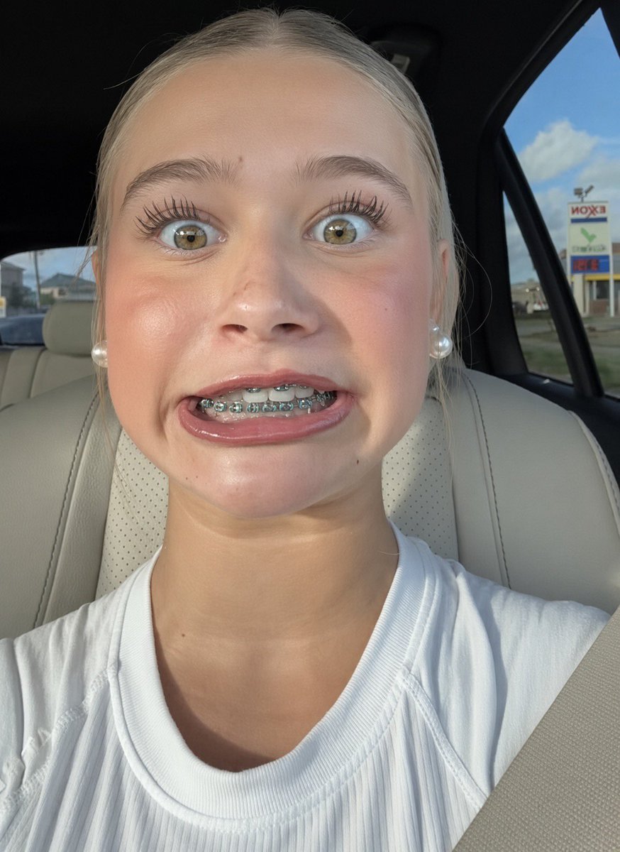 leaky4goddesses's tweet photo. Goddess Camille loves to trigger gooners with her naughty brace face. Brat knows just what to do to make that goon stick throb and leak cum. Keep stroking to those teeth dirty pervert 😵‍💫💖💦 https://t.co/WeGHDv5V6k