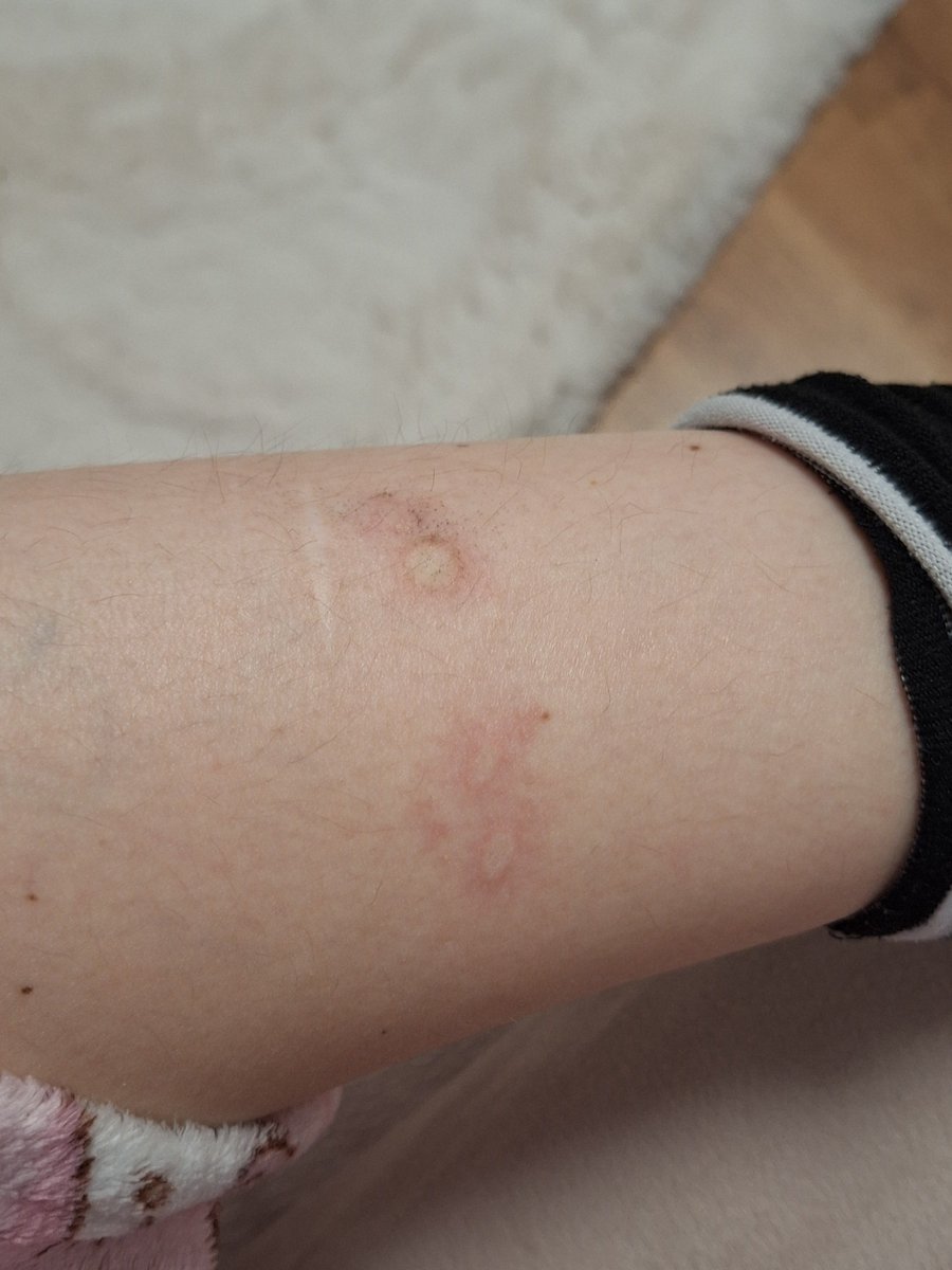 favorite_neeze's tweet photo. Ooohhh no i got an allergic reaction!! Nooo!! 👀👀 https://t.co/8xcQpunlBK